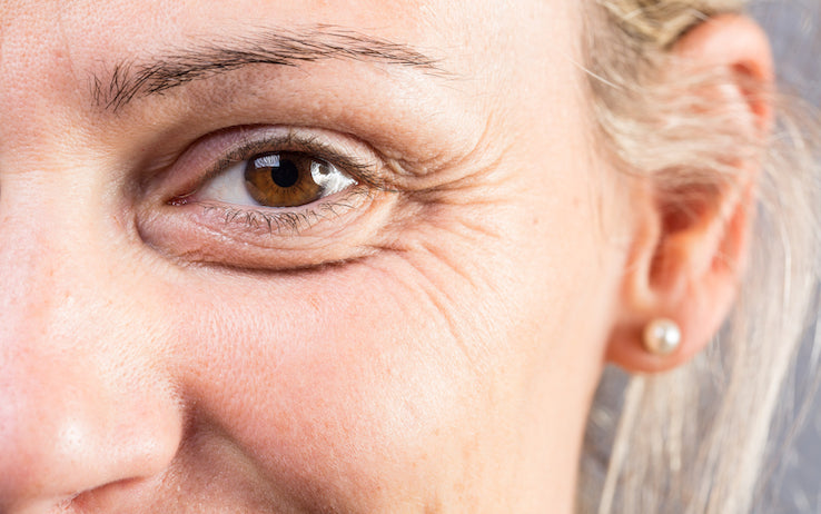 Rughe sottili, rughe profonde: l'approccio corretto