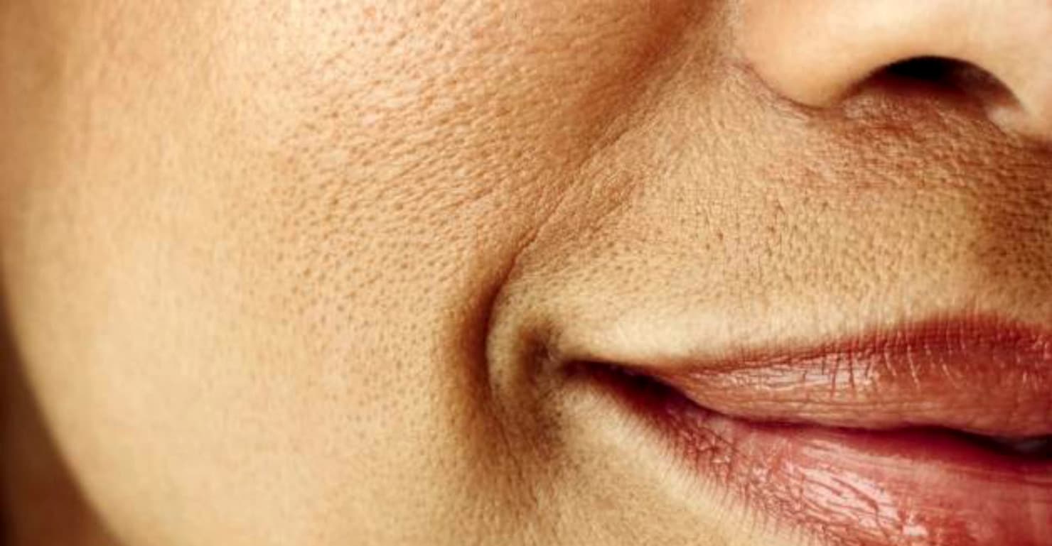 Pori ostruiti e invecchiamento della pelle: cosa c'è da sapere?