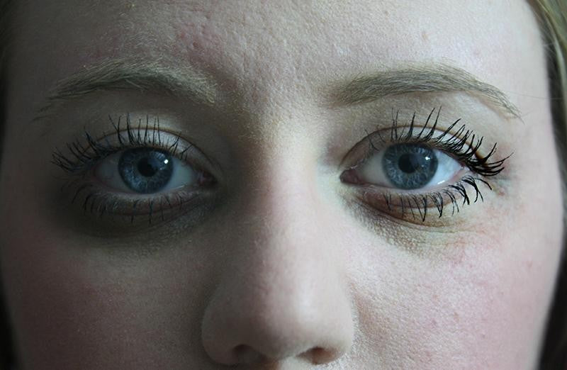 Come combattere le occhiaie con i rimedi naturali